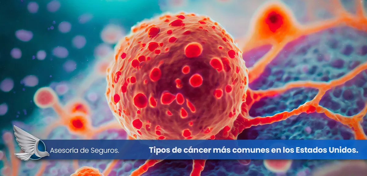 Los 16 tipos de cáncer más comunes en USA