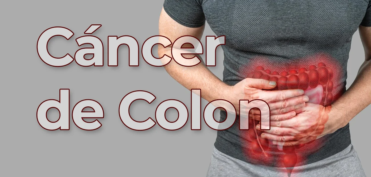 Síntomas de Cáncer de Colon: Una alerta precoz para salvar vidas