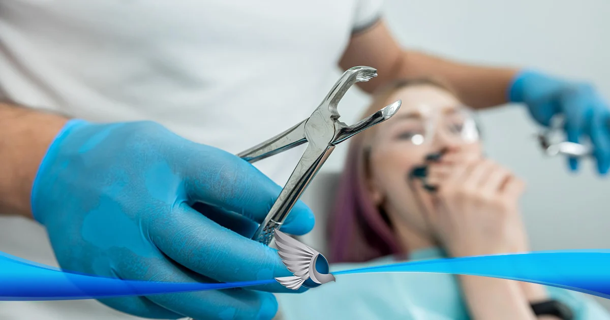 Emergencia dental: ¿qué hacer y cómo actuar rápidamente?